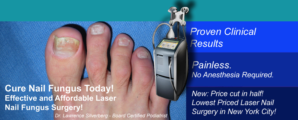 Best Priced Laser Toenail Fungus Treatment in NYC