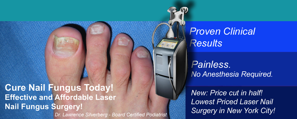 Laser Treatment for Toenail Fungus | Bay Area Podiatry Associates